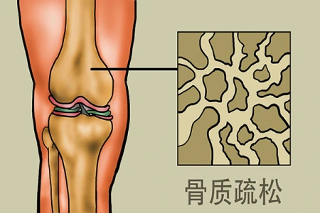 体重越轻越好？医生告诉你：体重过轻，健康问题风险会增加(体重轻了身体会瘦吗)